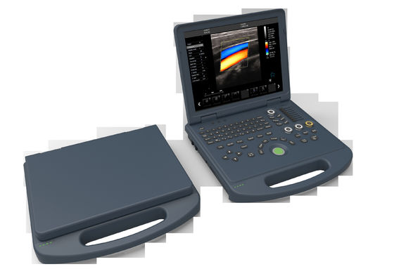 다기능 트롤리 유형 초음파 스캐닝 기계 가득 차있는 디지털 방식으로 초음파 진단 기구